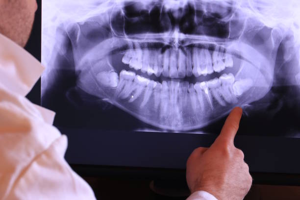 Best Mobile Emergency Dentist in Bergenfield, NJ